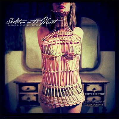 Eating Disordered Lives