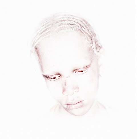 18.Albino Girl